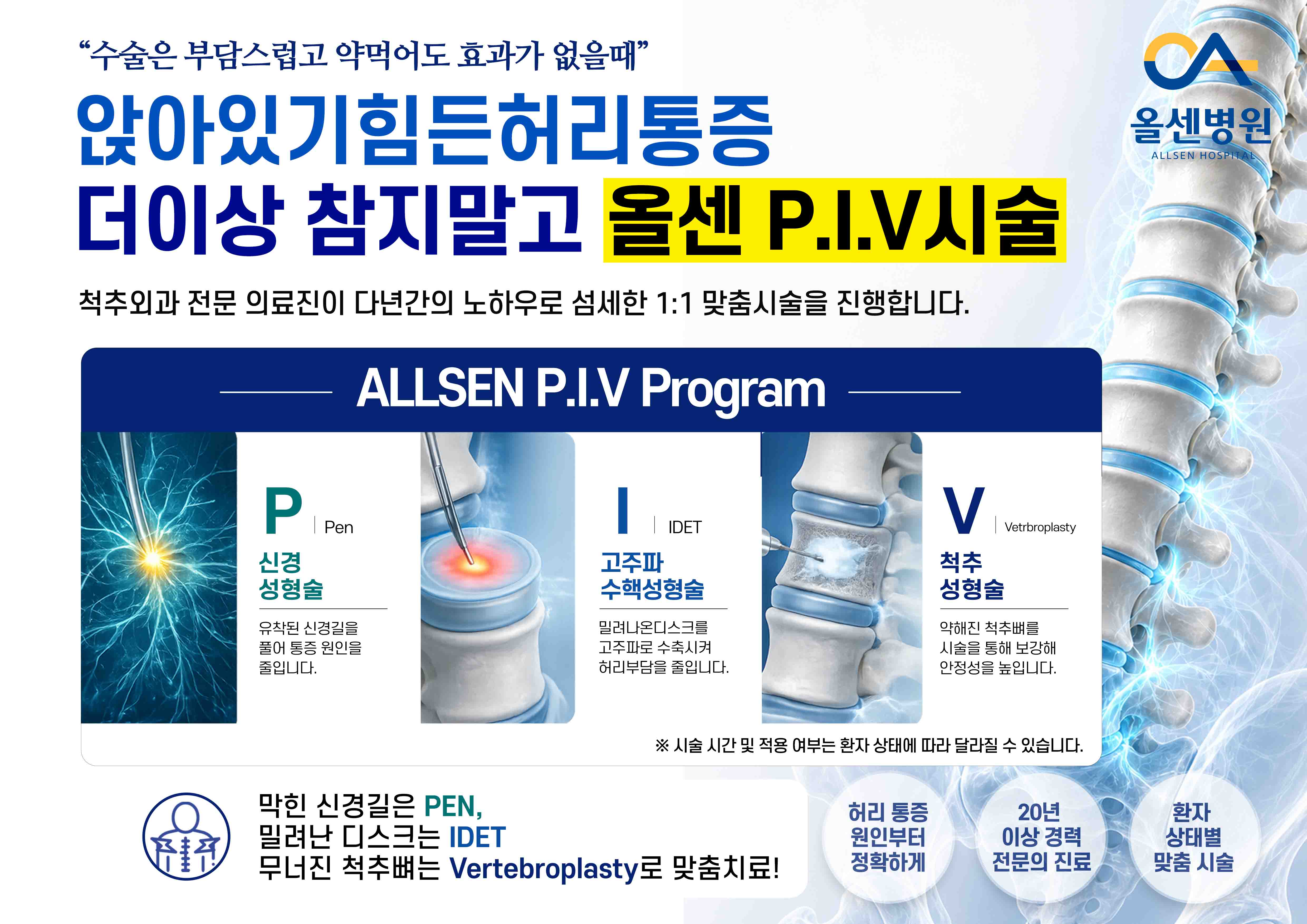 PIV시술