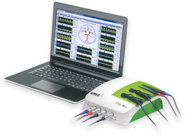 뇌혈류 초음파 (TCD)